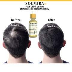 Rapid Hair grow Serum 50ml SOLMIRA ( Non Oily)