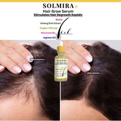 Rapid Hair grow Serum 50ml SOLMIRA ( Non Oily)